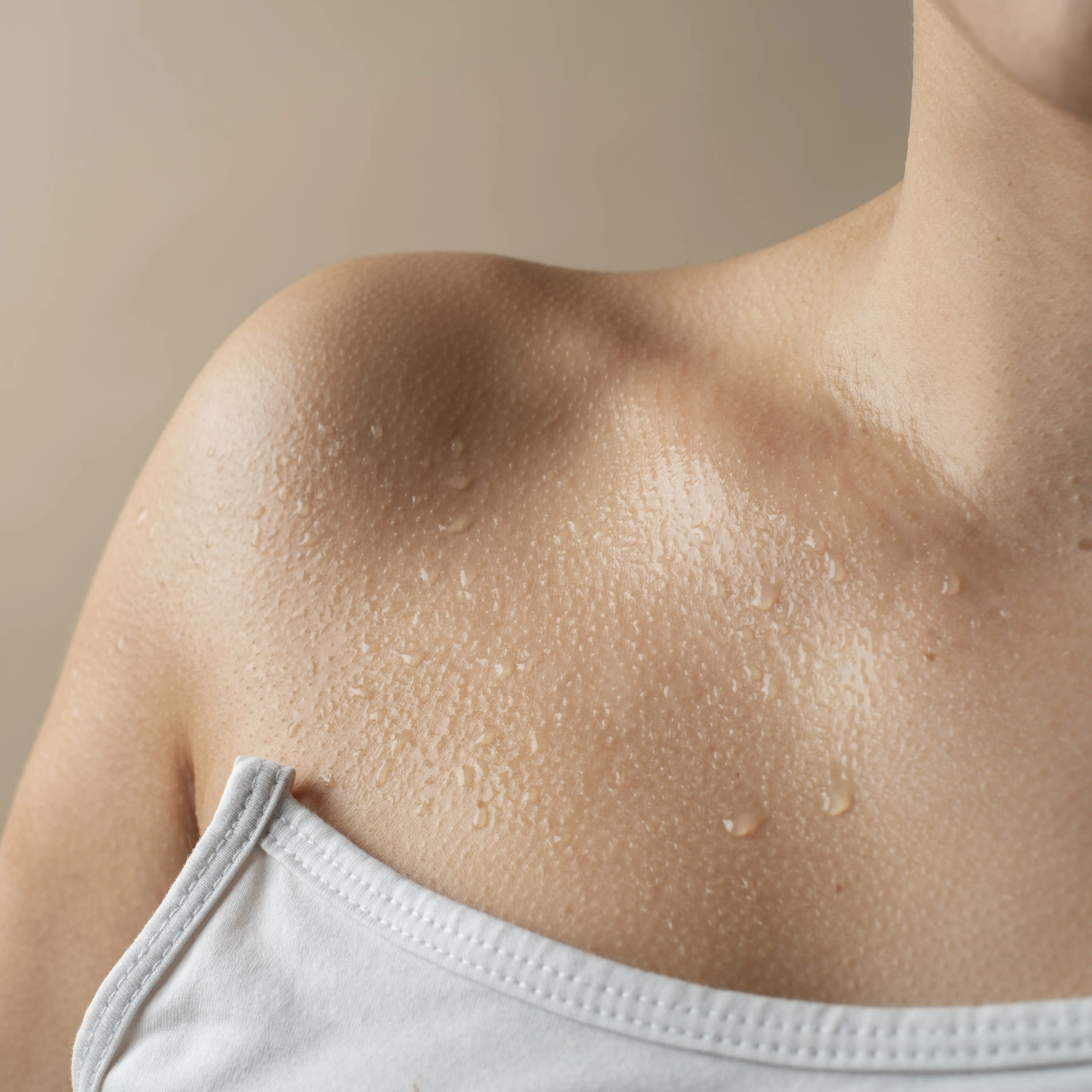 Hiperhidrosis
